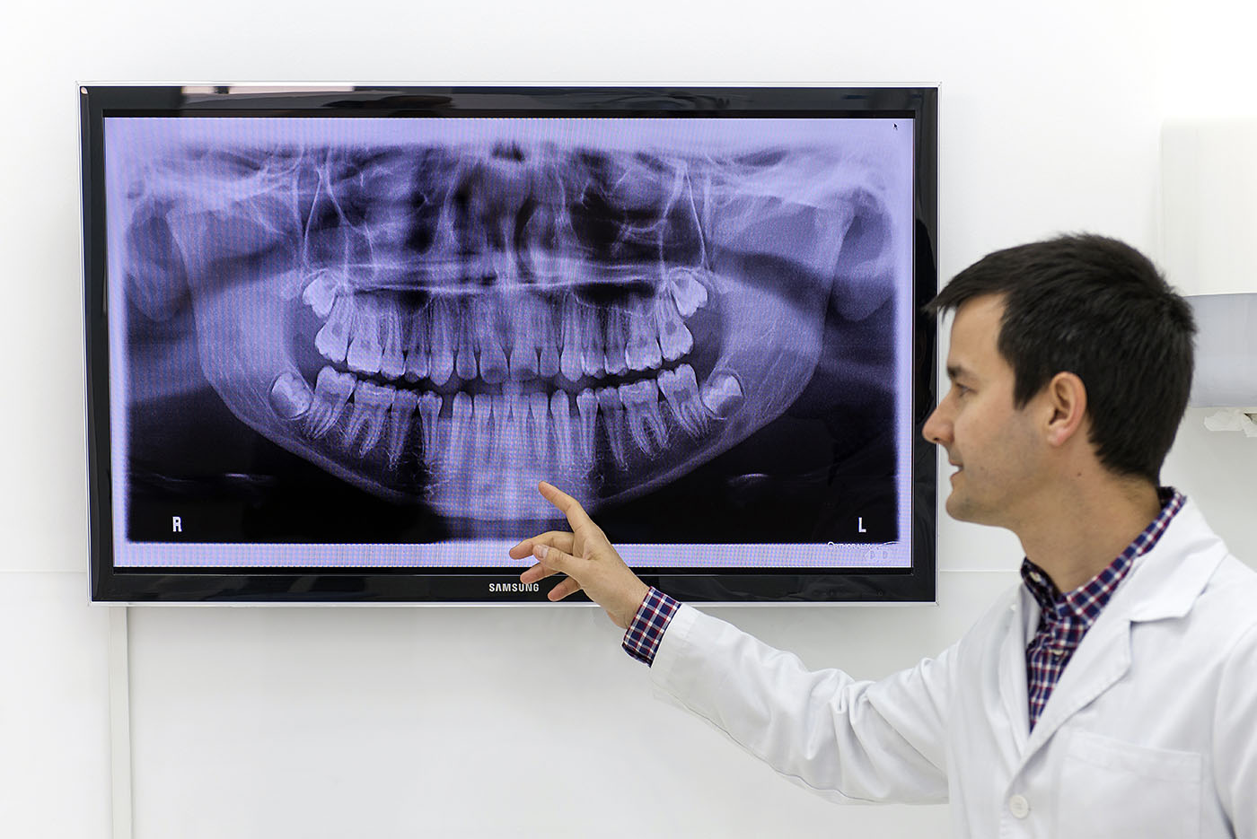 explicación de implante dental